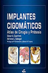 IMPLANTES CIGOMATICOS. ATLAS DE CIRUGIA Y PROTESIS | 9788493779320 | Portada