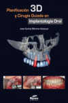 Planificación 3D y Cirugía Guiada en Implantología Oral | 9788494023217 | Portada