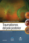 Traumatismos del polo posterior + acceso web | 9788491130529 | Portada