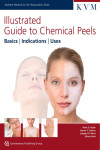 Illustrated Guide to Chemical Peels | 9781850972525 | Portada