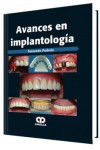 Avances en Implantología | 9789585911338 | Portada