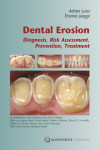 Dental Erosion: Diagnosis, Risk Assessment, Prevention, Treatment | 9781850972181 | Portada
