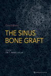 The Sinus Bone Graft | 9780867157918 | Portada