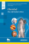 Obesidad. Una enfermedad crónica + ebook | 9788491107019 | Portada