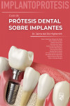 IMPLANTOPRÓTESIS. Guía de Prótesis Dental sobre Implantes | 9788412733310 | Portada