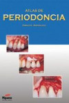 Atlas de Periodoncia | 9788461185429 | Portada