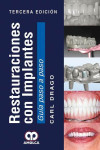 RESTAURACIONES CON IMPLANTES. GUIA PASO A PASO | 9789588950440 | Portada