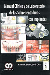 MANUAL CLINICO Y DE LABORATORIO DE LAS SOBREDENTADURAS CON IMPLANTES | 9789588473161 | Portada