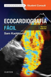 Ecocardiografía fácil + StudentConsult | 9788491131847 | Portada