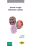 Avances en lupus eritematoso sistémico | 9788415340201 | Portada