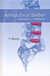 HERNIA DISCAL LUMBAR. DIAGNOSTICO Y TRATAMIENTO | 9788484739234 | Portada