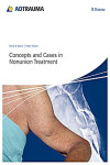 CONCEPTS AND CASES IN NONUNION TREATMENT | 9783131658517 | Portada