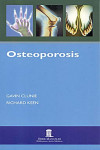 OSTEOPOROSIS | 9788478855049 | Portada