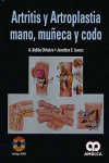ARTRITIS Y ARTROPLASTIA MANO, MUÑECA Y CODO | 9789587550405 | Portada