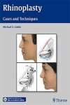 RHINOPLASTY | 9781604066807 | Portada