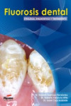 Fluorosis Dental | 9788493779313 | Portada