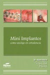 Mini implantes como Anclaje en Ortodoncia | 9788493927523 | Portada