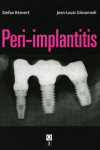 PERI-IMPLANTITIS | 9782912550989 | Portada