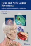 HEAD AND NECK CANCER RECURRENCE | 9783131473912 | Portada