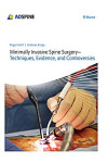 MINIMALLY INVASIVE SPINE SURGERY | 9783131723819 | Portada