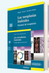 Las neoplasias linfoides | 9788498357523 | Portada