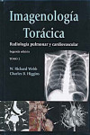 IMAGENOLOGIA TORACICA. RADIOLOGIA PULMONAR Y CARDIOVASCULAR | 9789588760742 | Portada