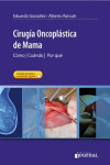 CIRUGIA ONCOPLASTICA DE MAMA | 9789871981014 | Portada