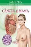 atlas de CÁNCER de MAMA | 9788415351450 | Portada