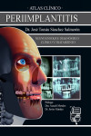 Atlas clínico de Periimplantitis | 9788494231803 | Portada