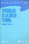 EPIFISIÓLISIS DE LA CABEZA FEMORAL | 9788495670496 | Portada