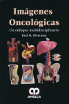 IMAGENES ONCOLOGICAS. UN ENFOQUE MULTIDISCIPLINARIO | 9789588816739 | Portada