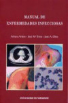 Manual de enfermedades infecciosas | 9788484488132 | Portada