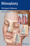 RHINOPLASTY. THE EXPERTS' REFERENCE | 9781604068672 | Portada