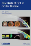 ESSENTIALS OF OCT IN OCULAR DISEASE | 9781626230989 | Portada