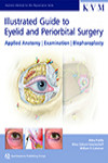 Illustrated Guide to Eyelid and Periorbital Surgery: Applied Anatomy, Examination, Blepharoplasty | 9781850972723 | Portada