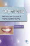 Tooth Whitening: Indications and Outcomes of Nightguard Vital Bleaching | 9780867154504 | Portada