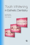 Tooth Whitening in Esthetic Dentistry | 9781850971771 | Portada