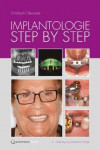 Implantology Step by Step | 9781850972815 | Portada