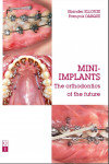 Mini-Implants The orthodontics of the future | 9782366150186 | Portada