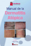 MANUAL DE LA DERMATITIS ATOPICA | 9788478855988 | Portada