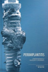 PERIIMPLANTITIS. UN NUEVO ENFOQUE A LA PREVENCION Y SU TRATAMIENTO | 9788487673290 | Portada