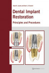 Dental Implant Restoration: Principles and Procedures | 9781850971016 | Portada