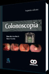 COLONOSCOPIA | 9789588950136 | Portada