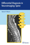 DIFFERENTIAL DIAGNOSIS IN NEUROIMAGING: SPINE | 9781626234772 | Portada