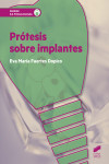 Prótesis sobre implantes | 9788490774816 | Portada