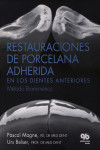 Restauraciones de Porcelana Adherida en los Dientes Anteriores: Un Enfoque Biomimético | 9788489873285 | Portada