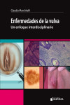 Enfermedades de la Vulva. un Enfoque Interdisciplinario | 9789873954559 | Portada