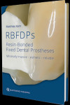 RBFDPs - Resin-Bonded Fixed Dental Prostheses | 9781786980205 | Portada