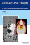 Skull Base Cancer Imaging. The Practical Approach to Diagnosis and Treatment Planning | 9781626232969 | Portada