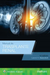 Manual de trasplante renal | 9788417033323 | Portada